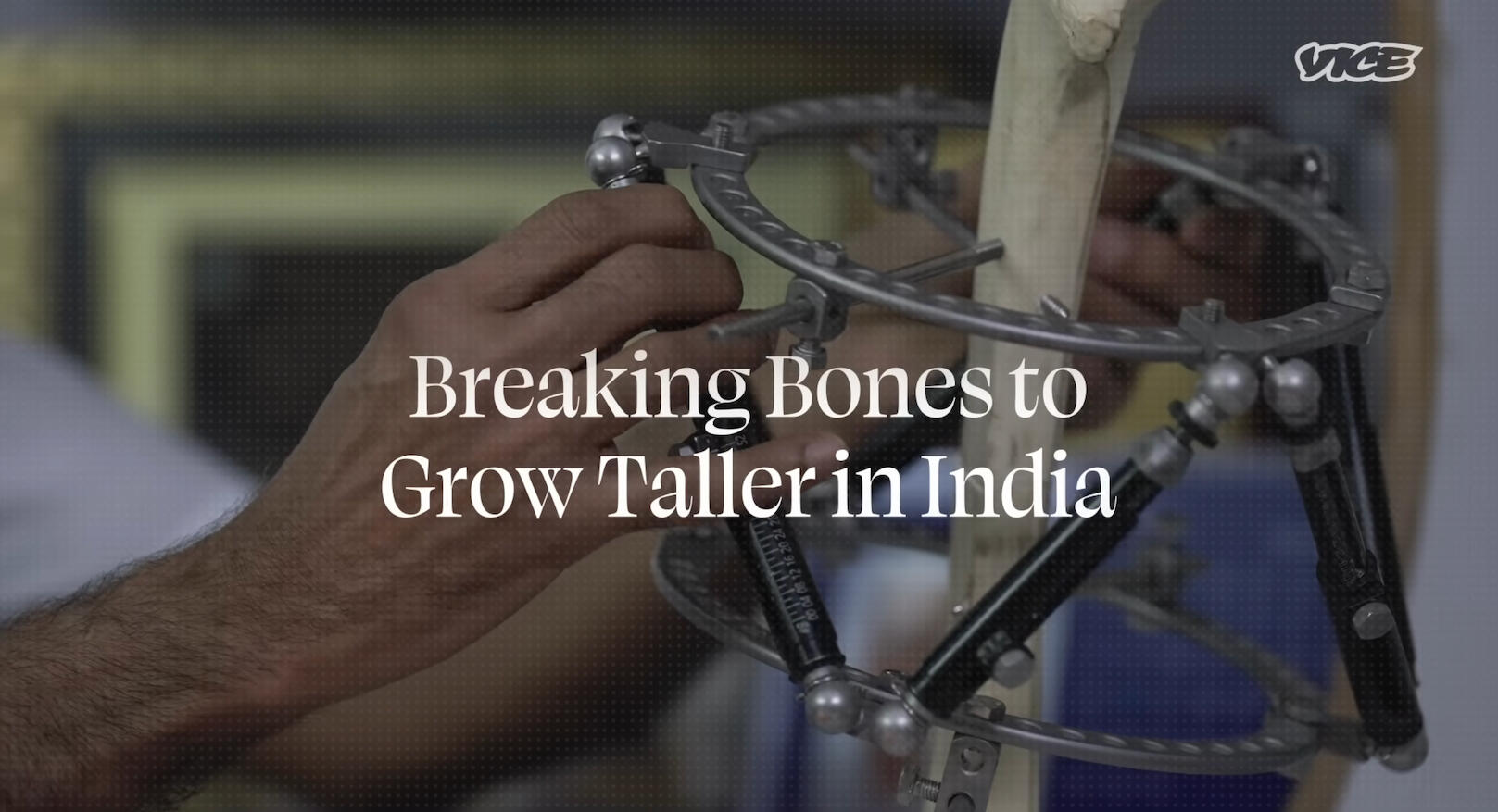 Title sequence — Breaking Bones to Grow Taller in India Title sequence — Breaking Bones to Grow Taller in India